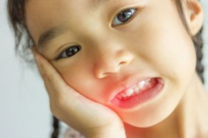 آبسه دندان شیری یا عفونت دندان شیری | تیم دندانپزشکی نیل - Nil Dental Team