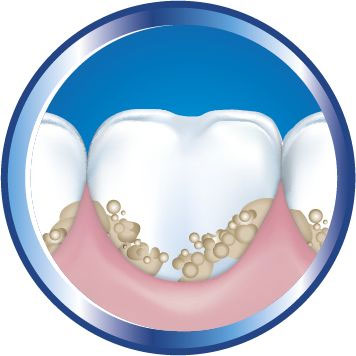 انواع خمیردندان | تیم دندانپزشکی نیل - Nil Dental Team