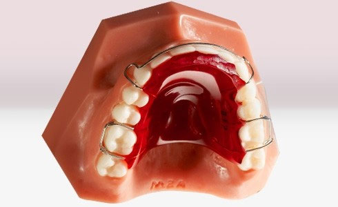 مکیدن انگشت در بازه سنی بزرگتر از 6 سال | تیم دندانپزشکی نیل - Nil Dental Team