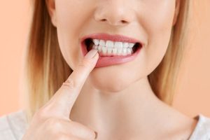 پریودنتیت چیست؟ | تیم دندانپزشکی نیل - Nil Dental Team