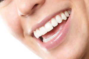 افزایش طول تاج دندان چیست؟ | تیم دندانپزشکی نیل - Nil Dental Team