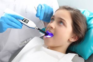 شيار درمانی يا فيشورسيلانت چیست؟ | تیم دندانپزشکی نیل - Nil Dental Team