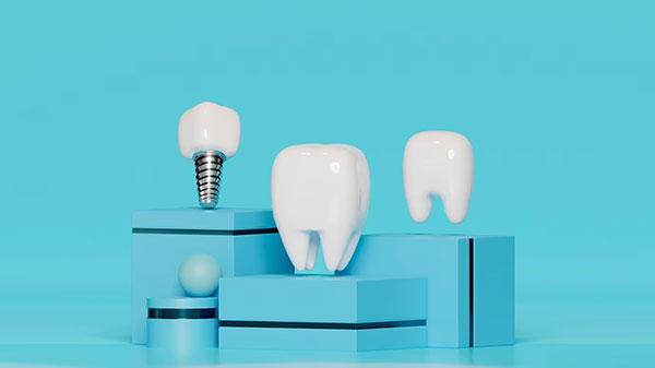 مراقبت‌های ایمپلنت دندانی از دندان واقعی بیشتر است | تیم دندانپزشکی نیل - Nil Dental Team